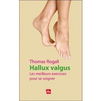 Hallux valgus : les meilleurs exercices pour se soigner