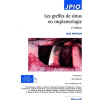 Les greffes de sinus en implantologie