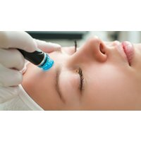 Aquapeeling mit Ultraschall Hamburg – Glow-Magie mitten in Winterhude erleben! Aquapeeling mit Ultraschall Hamburg – Glow-Magie mitten in Winterhude erleben!