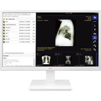 LG 24CK560N-3A All-in-One PC/workstation AMD G 60.5 cm (23.8") 19