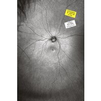 Supplement 3: The Invention and Conclusion of the Eye