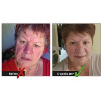 Easylife Zero Bs Face Butter, Size 50ml