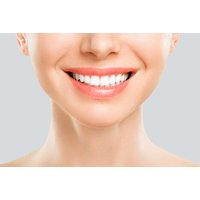 60-Minute Laser Teeth Whitening Session at Haus of Skin - On-Site Treatment in Stoke-on-Trent | Things To Do