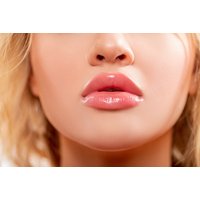 Filler on Choice of Area (1.1ml or 2.2ml) at Rejuvenate Aesthetics, Dudley | Things To Do