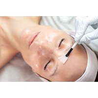 TCA & AHA Chemical Peel at You Glo - 4 Locations Including Bedford, Southampton & Kensington | Things To Do