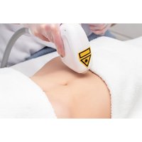 Six Diode Ice Laser Hair Removal Sessions | Things To Do