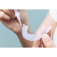 Custom Professional Teeth Whitening Kit with In-Clinic Consultation Included | Things To Do