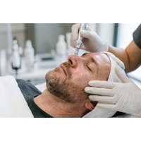 Microneedling & Skin Booster Facial - London | Things To Do