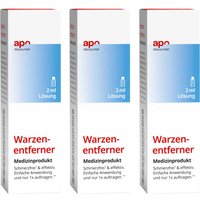 Warzenentferner für Hände und Füße Lösung
