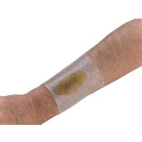 MPM Excel Hydrocolloid Transparent Wound Dressing,4-1/4" x 4",5/Pack,MP00602