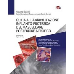 Guida Alla Riabilitazione Implantoprotesica Del Mascellare Posteriore Atrofico Guida Alla Riabilitazione Implantoprotesica Del Mascellare Posteriore Atrofico