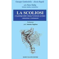 La Scoliosi E Le Patologie Della Colonna Vertebrale Correlate: Valutazione E Trattamento La Scoliosi E Le Patologie Della Colonna Vertebrale Correlate: Valutazione E Trattamento