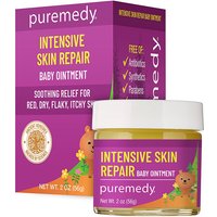 Baby Eczema Relief Ointment, 2 oz, Puremedy