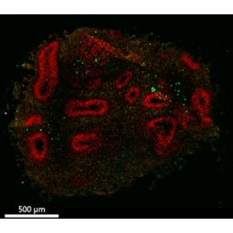TOMORROW:jetzt - Urania und Berlin Brains on Tour: Plastik im Kopf in Berlin