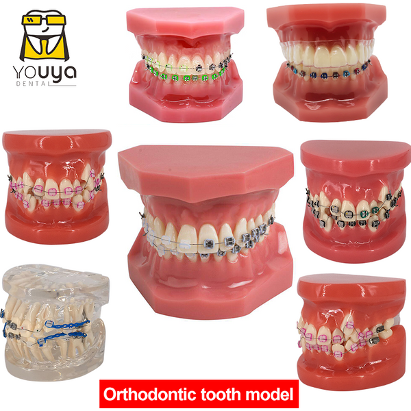 Dental Model With Braces Dentistry Materials Orthodontic Models Gum Tooth Teeth Model For Studying Teaching Patient Education