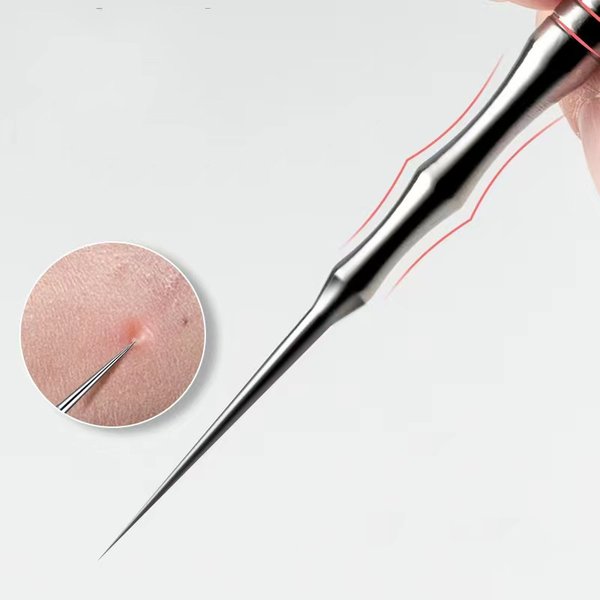 Neue deutsche ultrafeine Zellpickel Mitesser Whitehead Clip Schönheitssalon spezielle entfernen Akne Fettpartikel Nadelwerkzeug