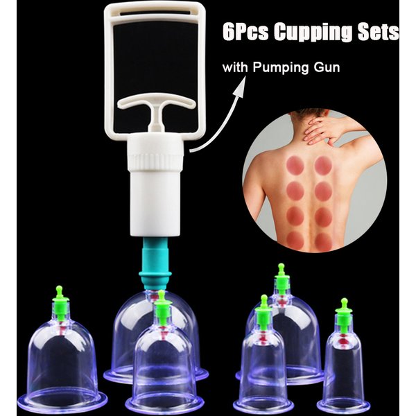 6-teiliges Vakuum-Schröpfen-Set mit Pumppistole, Saugnäpfe, Rückenmassage, Körperbecher, Detox, Anti-Cellulite-Dosen, gesunde Pflegegläser
