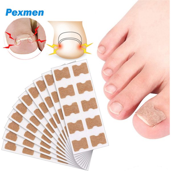 Pexmen 10/20/50/100/200Pcs Ingrown Toenail Stickers Toenail Patch Big Toe Nail Protector Patch