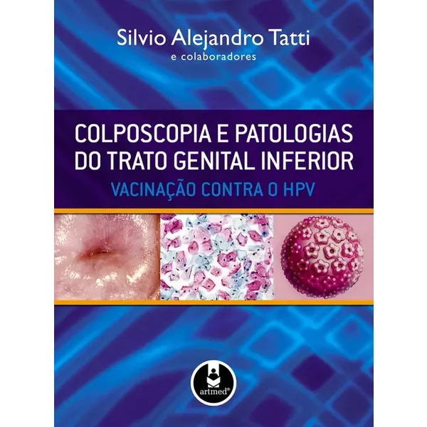 Colposcopia e Patologias do Trato Genital Inferior