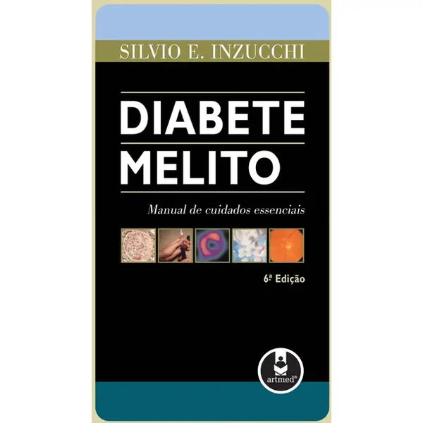 Diabete Melito