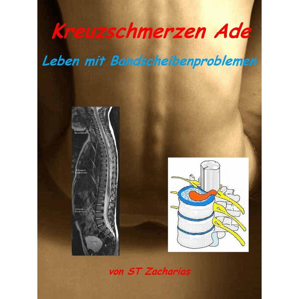 Kreuzschmerzen ade