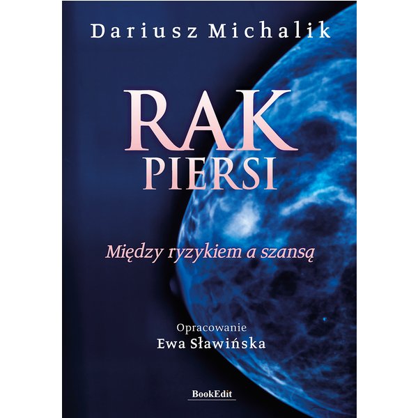 Rak piersi. Między ryzykiem a szansą
