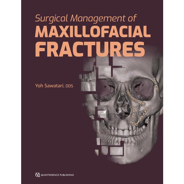 Surgical Management of Maxillofacial Fractures