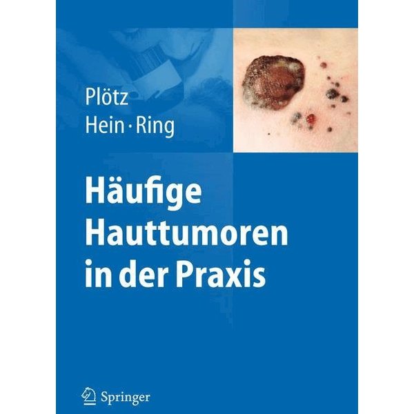 Häufige Hauttumoren in der Praxis