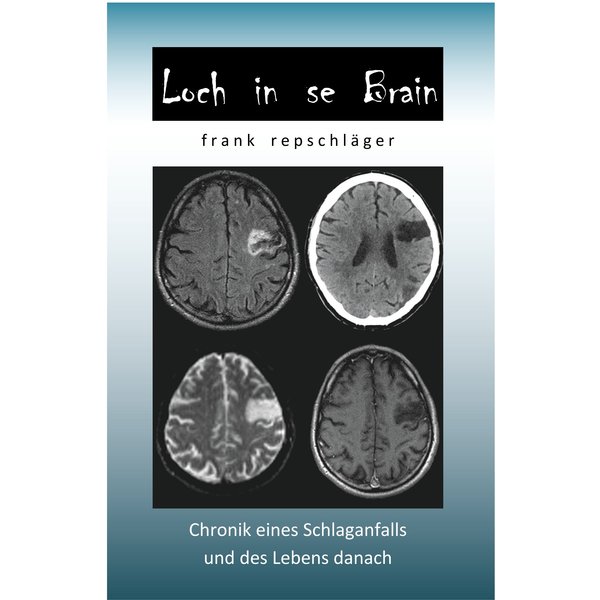 Loch in se Brain