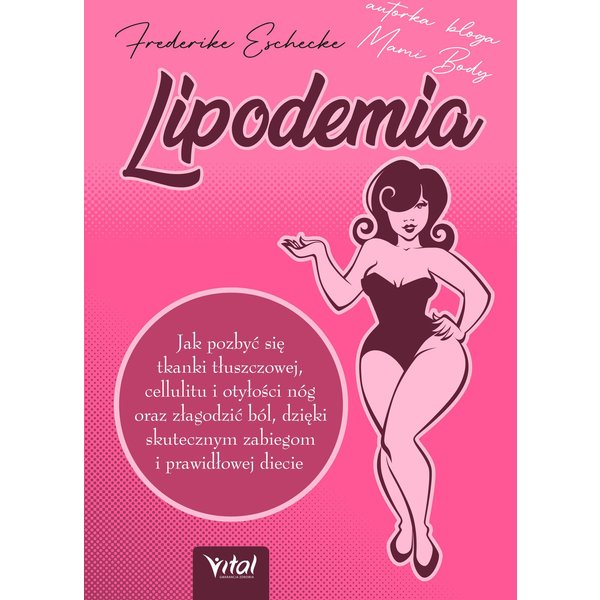 Lipodemia
