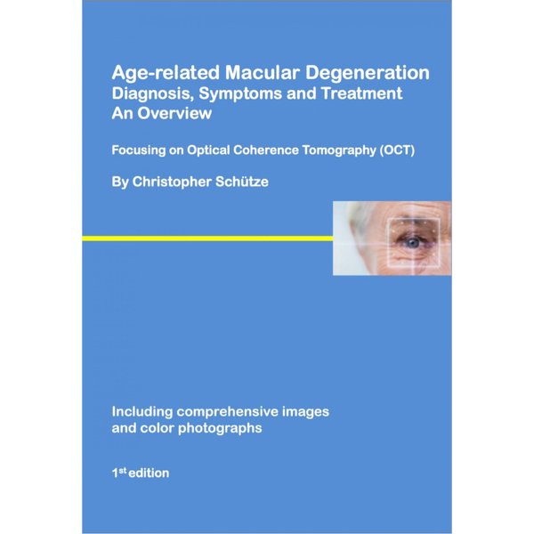 Age-related macular degeneration