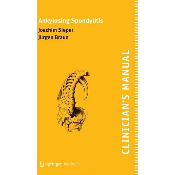 Clinician's Manual on Ankylosing Spondylitis