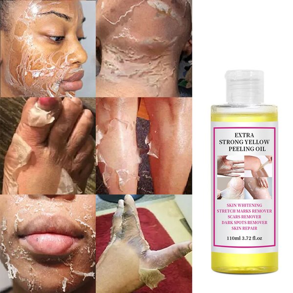 Full Body Whitening Peeling Oil - Exfoliating Nourishing Moisturizer For Unisex Skin Care Essential Oil Treatment