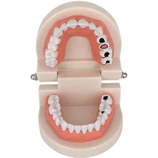 EducacióN Infantil Modelo De Cepillado EnseñAnza Oral Modelo Dental Modelo Dental De SimulacióN Grande Herramienta De EnseñAnza Montessori-image