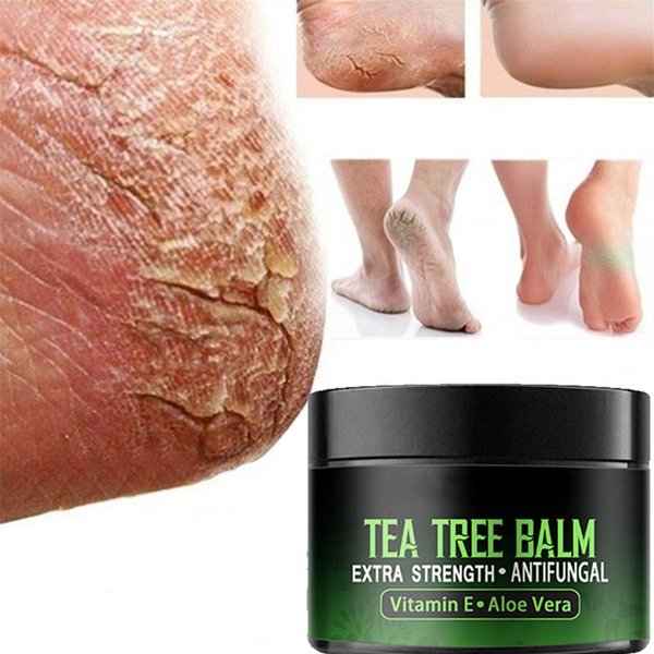 Anti-Drying Crack Krem Do StóP PięTy PęKnięTy Krem Naprawczy Usuwanie Martwa SkóRa DłOni PielęGnacja StóP PielęGnacja SkóRy DłOni I StóP 60G-image