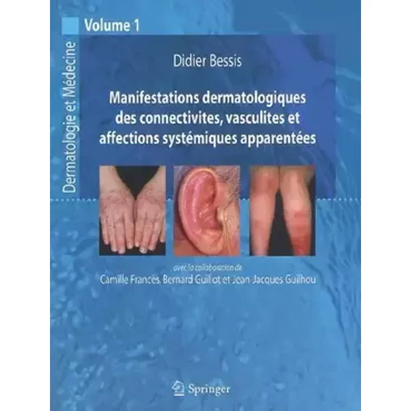 Manifestations dermatologiques des connectivites, vasculites et affections systémiques apparentées: Vol. 1 - Didier Bessis, Jean-Jacques Guilhou, Bernard Guillot, Camille Francès