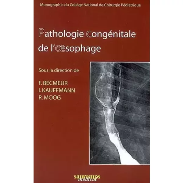 PATHOLOGIE CONGENITALE DE L'OESOPHAGE GEUP 2006 - BECMEUR