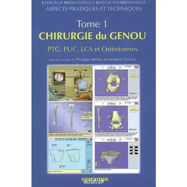 CHIRURGIE DU GENOU, TOME 1 - MERLIOZ
