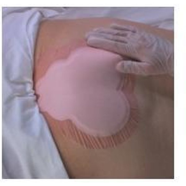 Allevyn Sacrum Medicazione Adesiva Idrocellulare Per L'area Sacrale 2,5X22,1 Cm - 10 Pezzi-image