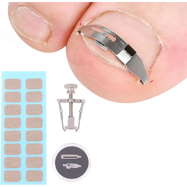 1 Set Ingrown Toenail Corrector Tools Pedicure Recover Embed Toe Nail Treatment Professional Foot Care Correction Tool