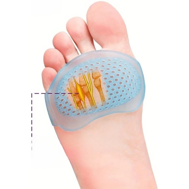 1Pairs Silicone Metatarsal Pads for Arch Support & Pain Relief - Ideal for Running, Hand Wash Only, Foot Arch Support