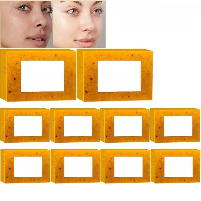 Turmeric Kojic Acid Glow Soap Dark Spot Acne Removal Even Skin Tone Smooth Skin Deep Cleansing Oil Control Face Skin Care