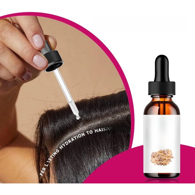 Frankincense Essential Oil Silky Smooth Hair Moisturizes and Softens Hair, Hair Care Essential Oil Prevents Improves Hair Loss