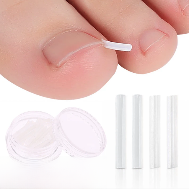 50pcs Ingrown Toenail Correction Tool Invisible Ingrown Toe Nail Treatment Pad Groove Straightening Clip Brace Foot Care Tool