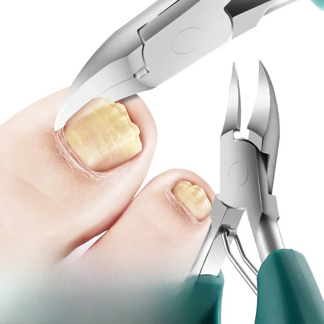Nail Clippers Ingrown Toenail Podiatry Correction Nippers Cuticle Cutters Cut Paronychia Pedicure Manicure Hand Foot Care Tool