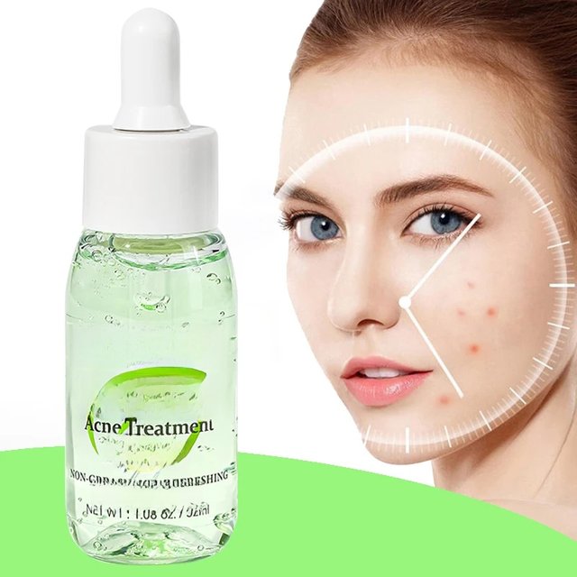 AUQUEST Herbal Acne Treatment Face Serum Salicylic Acid Oil Control Pimple Remover Facial Acne Removal Skin Care