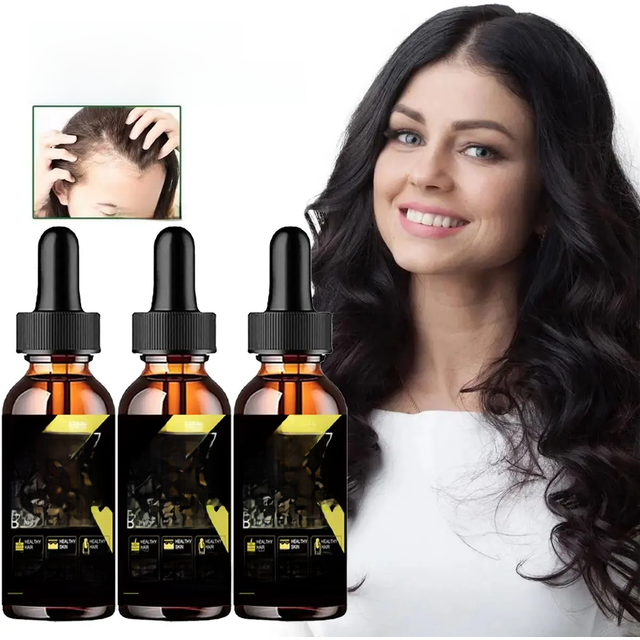 Hair Growth Essential Oil Strengthen Hair Roots Anti Hair Loss Hair Care Head Care Essential Oils for men Styling Appliances