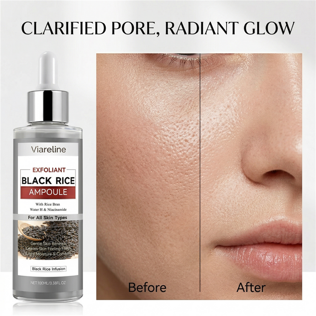 Black Rice Exfoliating Serum Facial Cleansing Peeling Solution Pore Minimizer Blackhead Remover Brightening Antioxidant Face Ess