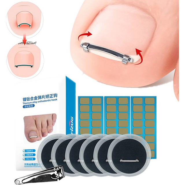Curved Clamp Ingrown Toenail Pedicure Tool Toe Nail Care Straightening Correction Clip Embed Nail Care Tool for Toes