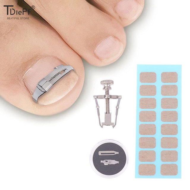 1set Ingrown Toenail Corrector Tools Pedicure Recover Embed Toe Nail Treatment Professional Foot Care Correction Tool Foot Care